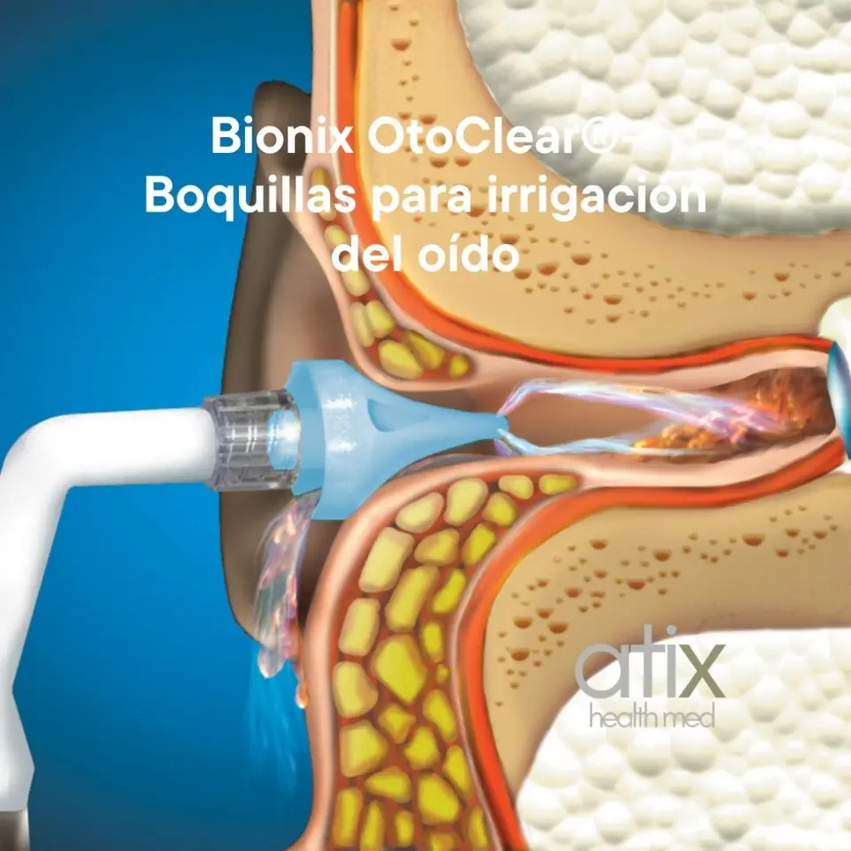 Kit OtoClear Aquabot® de Bionix para la limpieza auditiva, diseño eficiente que permite utilizar ambas manos en el procedimiento, proporciona un chorro continuo sin necesidad de bombear manualmente para procedimientos médicos seguros y precisos